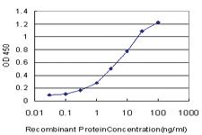 Anti-SALL2 Mouse Monoclonal Antibody [clone: 3F7]