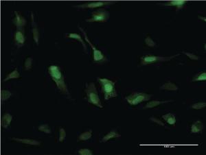 Anti-SOD1 Mouse Monoclonal Antibody [clone: 10D5]