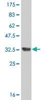 Anti-PRELP Mouse Monoclonal Antibody [clone: 3H1]