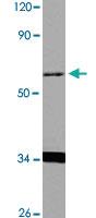 Anti-TBX22 Rabbit Polyclonal Antibody