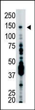 Anti-USP7 Rabbit Polyclonal Antibody (APC (Allophycocyanin))