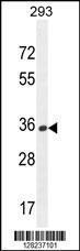 Anti-OR10H1 Rabbit Polyclonal Antibody (AP (Alkaline Phosphatase))