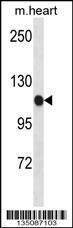 Anti-SCYL2 Rabbit Polyclonal Antibody (Biotin)