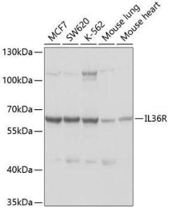 Western blot analysis of extracts of various cell lines, using Anti-IL-36R Antibody (A11237) at 1:1,000 dilution The secondary antibody was Goat Anti-Rabbit IgG H&L Antibody (HRP) at 1:10,000 dilution Lysates/proteins were present at 25 µg per lane