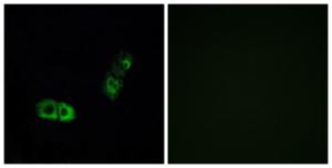 Antibody anti-BRS3 A100011-100 100 µg