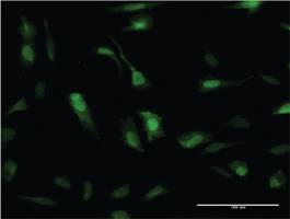 Anti-SOD1 Mouse Monoclonal Antibody [clone: 10D5]