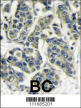 Anti-RPS6KB1 Rabbit Polyclonal Antibody (AP (Alkaline Phosphatase))