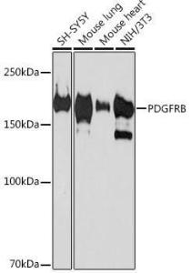 Western blot analysis of extracts of various cell lines, using Anti-PDGFR beta Antibody [ARC0009] (A308762) at 1:1,000 dilution. The secondary antibody was Goat Anti-Rabbit IgG H&L Antibody (HRP) at 1:10,000 dilution.