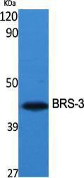 Antibody anti-BRS3 A100011-100 100 µg