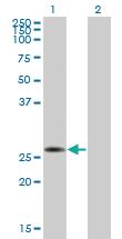 Anti-MED7 Mouse Monoclonal Antibody [clone: 3E7]