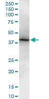 Anti-TBX6 Mouse Monoclonal Antibody [clone: 3F11]