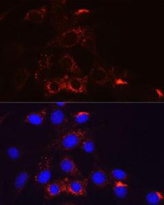 Immunofluorescence analysis of NIH-3T3 cells using Anti-PDGFR beta Antibody [ARC0009] (A308762). DAPI was used to stain the cell nuclei (blue).