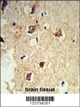 Anti-GABARAPL2 Rabbit Polyclonal Antibody