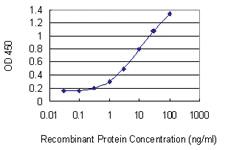 Anti-SOD1 Mouse Monoclonal Antibody [clone: 10D5]