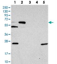 Anti-PYROXD2 Rabbit Polyclonal Antibody