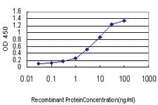 Anti-IRAK3 Mouse Monoclonal Antibody [clone: 1F6]