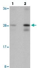 Anti-SPATA3 Rabbit Polyclonal Antibody