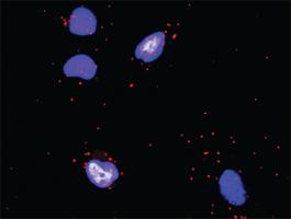 Anti-OSM + COL4A6 Antibody Pair