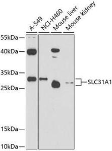 Western blot analysis of extracts of various cell lines, using Anti-SLC31A1/CTR1 Antibody (A11242) at 1:1,000 dilution