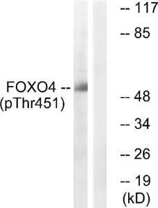 Western blot analysis of lysates from HUVEC cells treated with EGF 200ng/ml 5' using Anti-FOXO4 (phospho Thr451) Antibody. The right hand lane represents a negative control, where the antibody is blocked by the immunising peptide