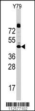 Anti-LAMP1 Rabbit Polyclonal Antibody