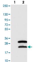 Anti-SNRNP27 Rabbit Polyclonal Antibody