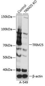 Western blot analysis of extracts from normal (control) and TRIM25 knockout (KO) A-549 cells, using Anti-TRIM25 / EFP Antibody (A308764) at 1:3,000 dilution. The secondary antibody was Goat Anti-Rabbit IgG H&L Antibody (HRP) at 1:10,000 dilution.