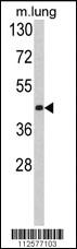 Anti-TNFAIP8L3 Rabbit Polyclonal Antibody