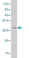 Anti-HAND2 Mouse Monoclonal Antibody [clone: 2C10]