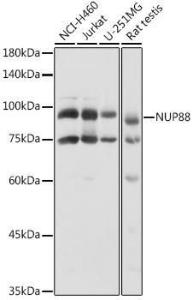 Western blot analysis of extracts of various cell lines, using Anti-NUP88 Antibody (A308765) at 1:1000 dilution. The secondary Antibody was Goat Anti-Rabbit IgG H&L Antibody (HRP) at 1:10000 dilution. Lysates/proteins were present at 25 µg per lane