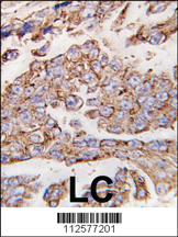 Anti-LAMP1 Rabbit Polyclonal Antibody