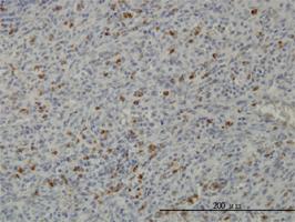 Anti-PRKAA1 Mouse Monoclonal Antibody [clone: 4D9]