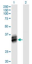 Anti-B4GALT4 Mouse Polyclonal Antibody