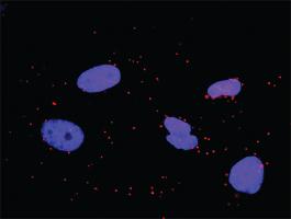 Anti-GAB1 + CRKL Antibody Pair