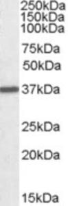 EB06795 (0.01 µg/ml) staining of Human Liver lysate (35 µg protein in RIPA buffer). Primary incubation was 1 hour. Detected by chemiluminescence.