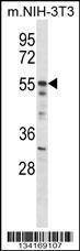 Anti-AKT2 Rabbit Polyclonal Antibody (FITC (Fluorescein Isothiocyanate))