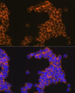 Immunofluorescence analysis of Jurkat cells using Anti-CD30 Antibody [ARC1750] (A308766) at a dilution of 1:100 (40X lens). DAPI was used to stain the cell nuclei (blue)