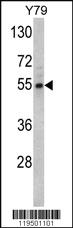 Anti-Fascin Rabbit Polyclonal Antibody