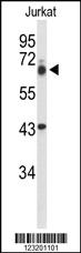 Anti-TLE1 Rabbit Polyclonal Antibody