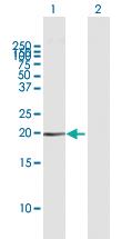 Anti-HMGA1 Mouse Polyclonal Antibody