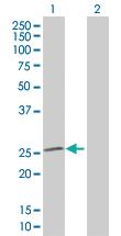 Anti-SOD2 Mouse Polyclonal Antibody