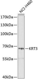 Antibody anti-KRT3 100 µl