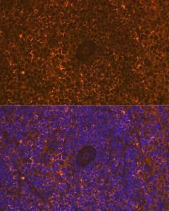 Immunofluorescence analysis of rat spleen using Anti-CD30 Antibody [ARC1750] (A308766) at a dilution of 1:100 (40X lens). DAPI was used to stain the cell nuclei (blue)