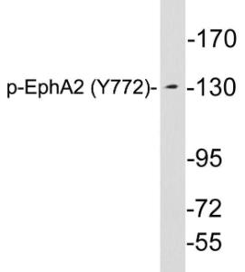 Antibody anti-EPHA2 phospho TYR772 100 µg