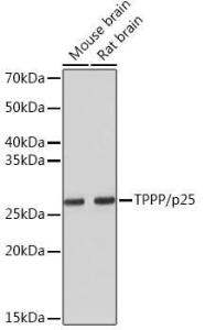 Western blot analysis of extracts of various cell lines, using Anti-TPPP Antibody [ARC1129] (A305920) at 1:5000 dilution