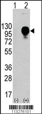 Anti-LAMP2 Rabbit Polyclonal Antibody