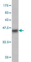 Anti-CD93 Mouse Monoclonal Antibody [clone: 3D12]