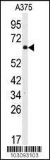 Anti-SRC Rabbit Polyclonal Antibody (AP (Alkaline Phosphatase))