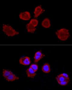 Antibody anti-KRT3 100 µl