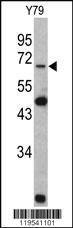 Anti-LMNB2 Rabbit Polyclonal Antibody